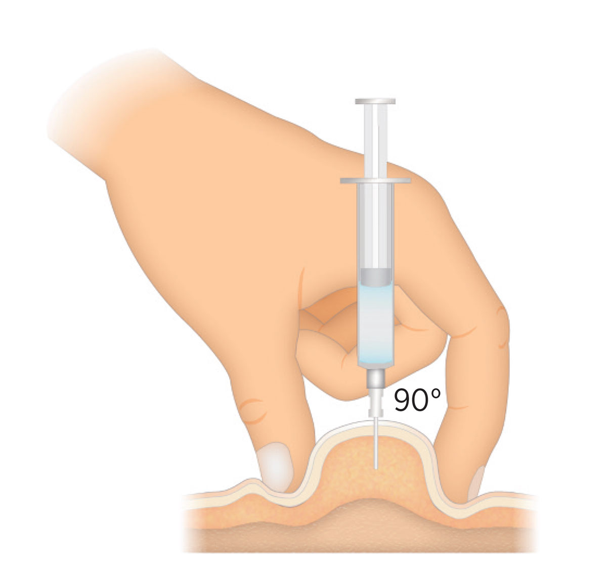 INIEZIONE-SOTTOCUTANEA